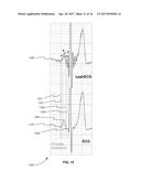 Systems and Methods for Providing Cardiac Electrophysiological Markers diagram and image