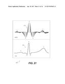 Systems and Methods for Providing Cardiac Electrophysiological Markers diagram and image