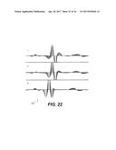 Systems and Methods for Providing Cardiac Electrophysiological Markers diagram and image