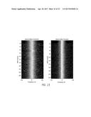 MR SPECTROSCOPY SYSTEM AND METHOD FOR DIAGNOSING PAINFUL AND NON-PAINFUL     INTERVERTEBRAL DISCS diagram and image