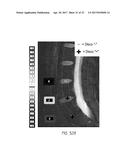 MR SPECTROSCOPY SYSTEM AND METHOD FOR DIAGNOSING PAINFUL AND NON-PAINFUL     INTERVERTEBRAL DISCS diagram and image