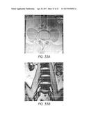 MR SPECTROSCOPY SYSTEM AND METHOD FOR DIAGNOSING PAINFUL AND NON-PAINFUL     INTERVERTEBRAL DISCS diagram and image