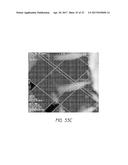 MR SPECTROSCOPY SYSTEM AND METHOD FOR DIAGNOSING PAINFUL AND NON-PAINFUL     INTERVERTEBRAL DISCS diagram and image