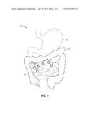 BIO-IMPEDANCE MEASUREMENT METHOD USING BI-PHASIC CURRENT STIMULUS     EXCITATION FOR IMPLANTABLE STIMULATOR diagram and image