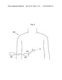 A voice control system for an implant diagram and image