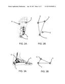 System for Three-Dimensional Measurement of Foot Alignment diagram and image