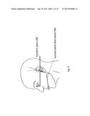 Dental Bite Block For 2D Imaging diagram and image