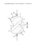 SEALING DEVICE AND DELIVERY SYSTEM diagram and image