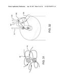 SEALING DEVICE AND DELIVERY SYSTEM diagram and image