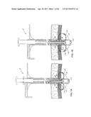 Apparatus and method for fascial closure device for laparoscopic trocar     port site and surgery diagram and image