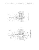 Apparatus and method for fascial closure device for laparoscopic trocar     port site and surgery diagram and image