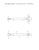 Apparatus and method for fascial closure device for laparoscopic trocar     port site and surgery diagram and image