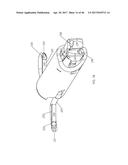 Apparatus and method for fascial closure device for laparoscopic trocar     port site and surgery diagram and image