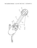 Apparatus and method for fascial closure device for laparoscopic trocar     port site and surgery diagram and image