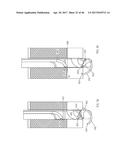 Apparatus and method for fascial closure device for laparoscopic trocar     port site and surgery diagram and image