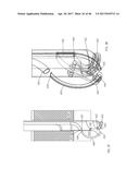 Apparatus and method for fascial closure device for laparoscopic trocar     port site and surgery diagram and image