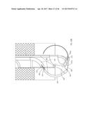 Apparatus and method for fascial closure device for laparoscopic trocar     port site and surgery diagram and image