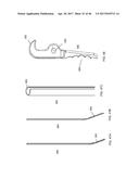 Apparatus and method for fascial closure device for laparoscopic trocar     port site and surgery diagram and image