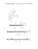 Apparatus and method for fascial closure device for laparoscopic trocar     port site and surgery diagram and image