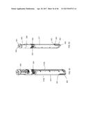 Apparatus and method for fascial closure device for laparoscopic trocar     port site and surgery diagram and image