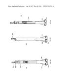 Apparatus and method for fascial closure device for laparoscopic trocar     port site and surgery diagram and image