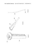 Apparatus and method for fascial closure device for laparoscopic trocar     port site and surgery diagram and image