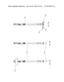 Apparatus and method for fascial closure device for laparoscopic trocar     port site and surgery diagram and image