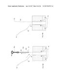 Apparatus and method for fascial closure device for laparoscopic trocar     port site and surgery diagram and image