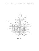 SUTURE RETENTION MECHANISM diagram and image