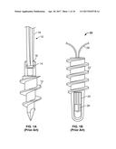 SUTURE ANCHOR AND ASSOCIATED SYSTEMS AND METHODS diagram and image