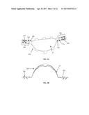 IMPLANTABLE FASTENER FOR ATTACHMENT OF A MEDICAL DEVICE TO TISSUE diagram and image