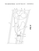 TISSUE RETRACTION DEVICES AND RELATED METHODS OF USE diagram and image