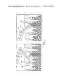 Loose Floss Method of Inter-dental Plaque Removal diagram and image