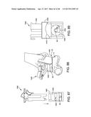 SYSTEM AND METHOD FOR ANTERIOR APPROACH FOR INSTALLING TIBIAL STEM diagram and image