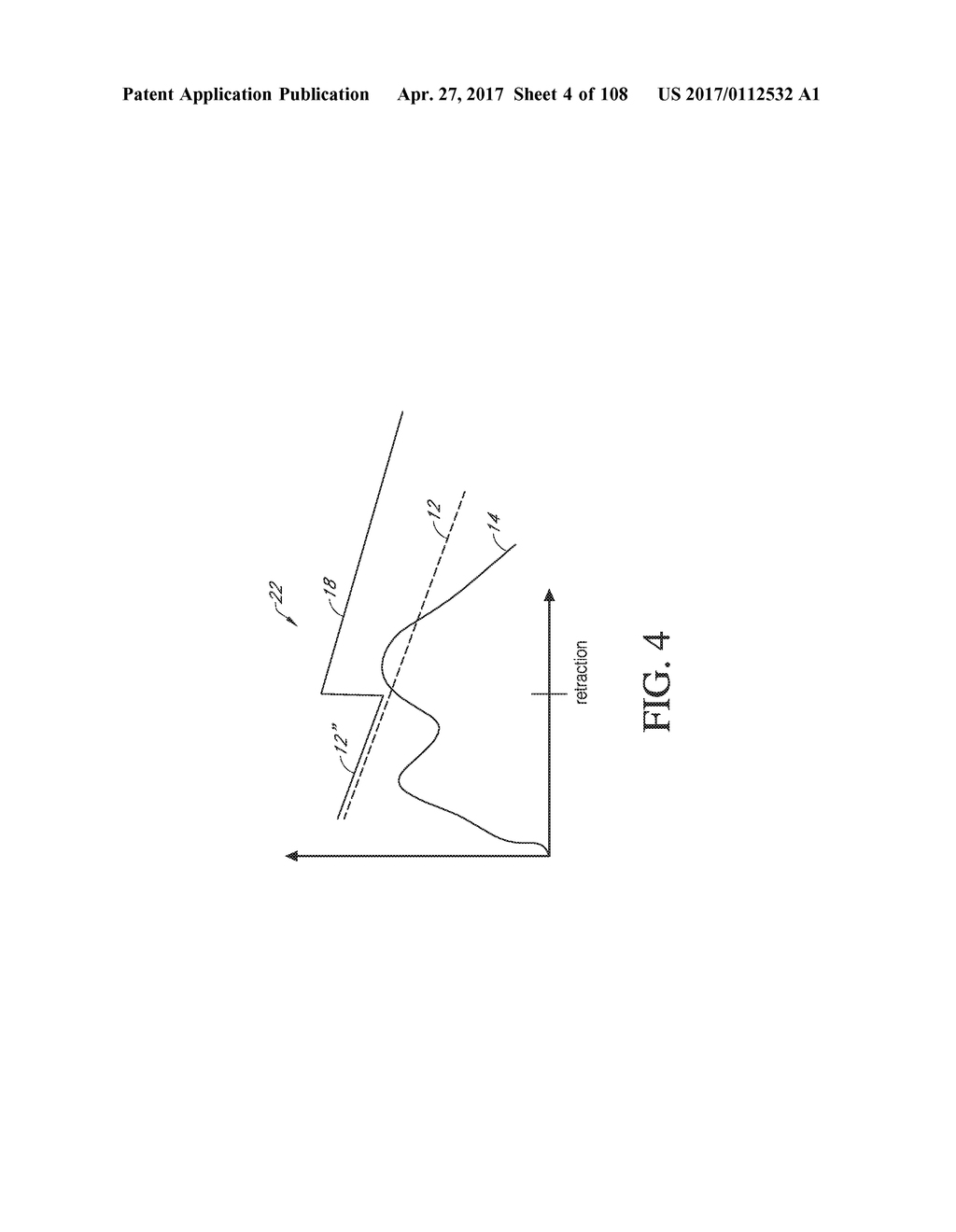 TRANSCUTANEOUS ANALYTE SENSORS, APPLICATORS THEREFOR, AND ASSOCIATED     METHODS - diagram, schematic, and image 05