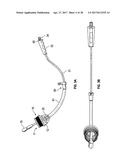 UTERINE MANIPULATOR diagram and image