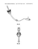 UTERINE MANIPULATOR diagram and image