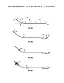 UTERINE MANIPULATOR diagram and image