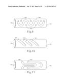 BIPOLAR ELECTROSURGICAL FEATURES FOR TARGETED HEMOSTASIS diagram and image