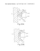 BIPOLAR ELECTROSURGICAL FEATURES FOR TARGETED HEMOSTASIS diagram and image