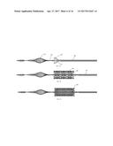 TRANSLUMINAL ANGIOPLASTY DEVICES AND METHODS OF USE diagram and image