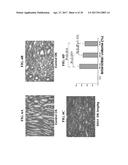 METHODS FOR PREVENTION AND TREATMENT OF ACUTE RENAL INJURY diagram and image