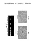 METHODS FOR PREVENTION AND TREATMENT OF ACUTE RENAL INJURY diagram and image