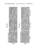 METHODS FOR PREVENTION AND TREATMENT OF ACUTE RENAL INJURY diagram and image