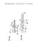 COAXIAL BI-DIRECTIONAL CATHETER diagram and image