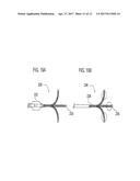 COAXIAL BI-DIRECTIONAL CATHETER diagram and image