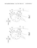 VEHICLE SEAT WITH HEAD AND NECK SUPPORT diagram and image