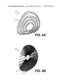 ACTUATING INDUCTOR PLACEMENT ASSEMBLY diagram and image