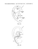 Earbud Monitoring Devices diagram and image
