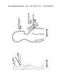 METHODS, SYSTEMS, AND APPARATUSES FOR ACCURATE MEASUREMENT AND REAL-TIME     FEEDBACK OF SOLAR  ULTRAVIOLET EXPOSURE diagram and image